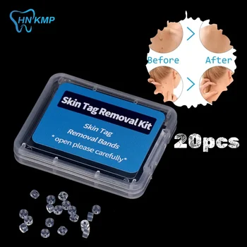 2mm-4mm Remove Skin Tag Shrink Rubber Ring 20pcs/box Non Toxic Health Beauty Skin Care Tools Tag Removal Mole Wart Removal 1