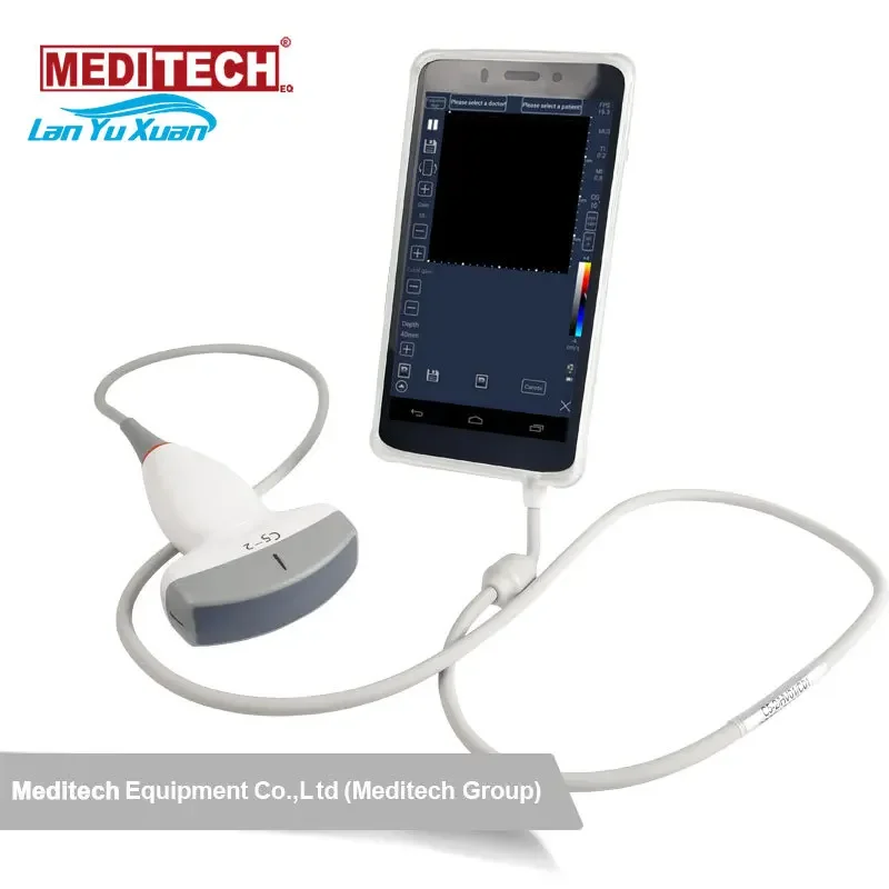 

Medical Ultrasound Instruments Dignostic Sonography Scanner System CE approved