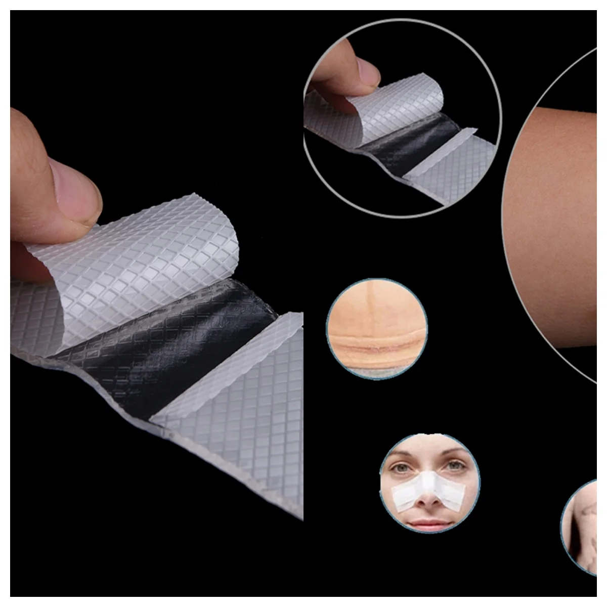 Narbe Therapie Entfernen Trauma Burn Silicon Patch Wiederverwendbare Akne Gel Haut Reparatur Neu