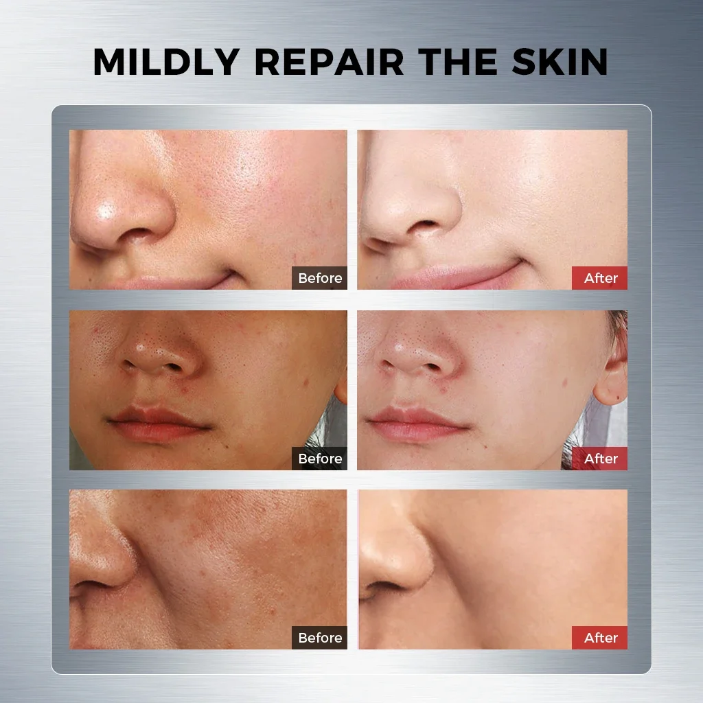 Dark Spot Care Serum with Niacinamide, Arbutin, Glabridin & Vitamin C Ampoule – Brightening & Soothing Skin