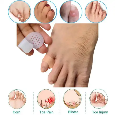 1/100 Pairs Gel Toe Separators Overlapping Small Finger Separate Bunion Corrector Pads Spacers Pain Relief Foot Protector
