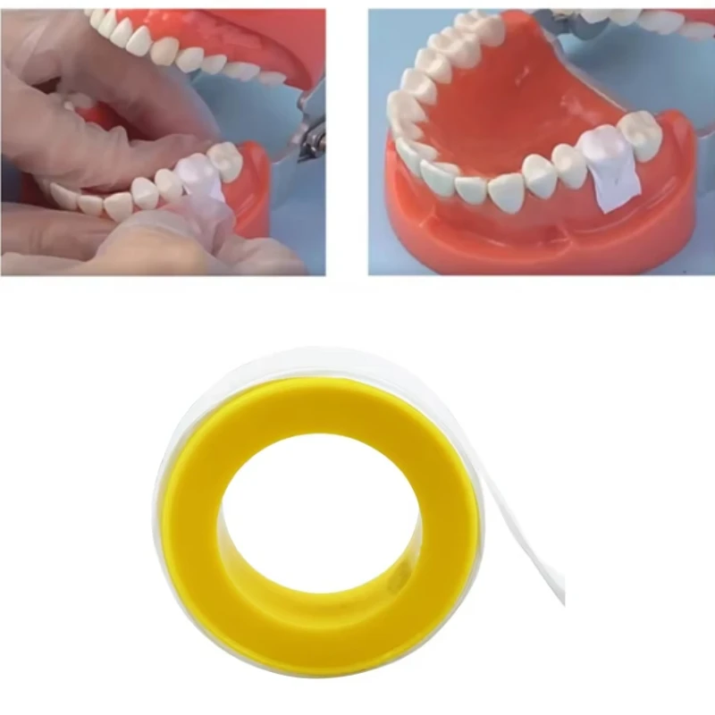 2 Roll Dental White Matrix Bands PTFE Retainer Strips Non Stick Tear-Resistant Tooth Restoration Filling Isolation Matrices