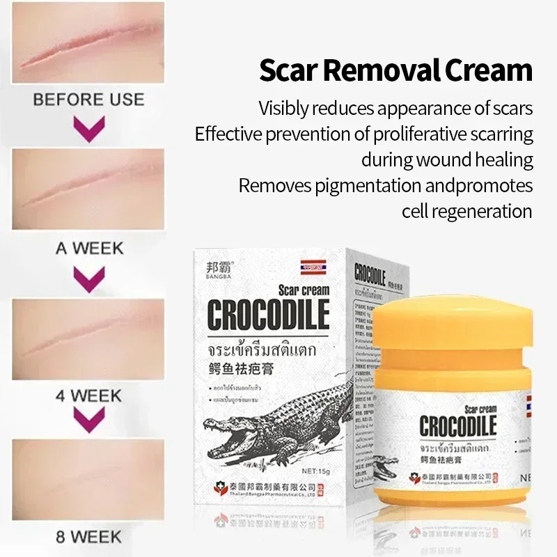 Thailand Scar Removal Cream Repair Trauma Fade Scars Old Scars Keloid Scar Treatment Burn Surgical Crocodile Ointment 15g