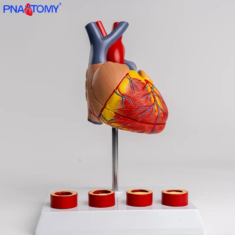 Heart Thrombus Model Anatomically Dissectable Teaching Simulation Natural-sized Heart Thrombus Vascular Model