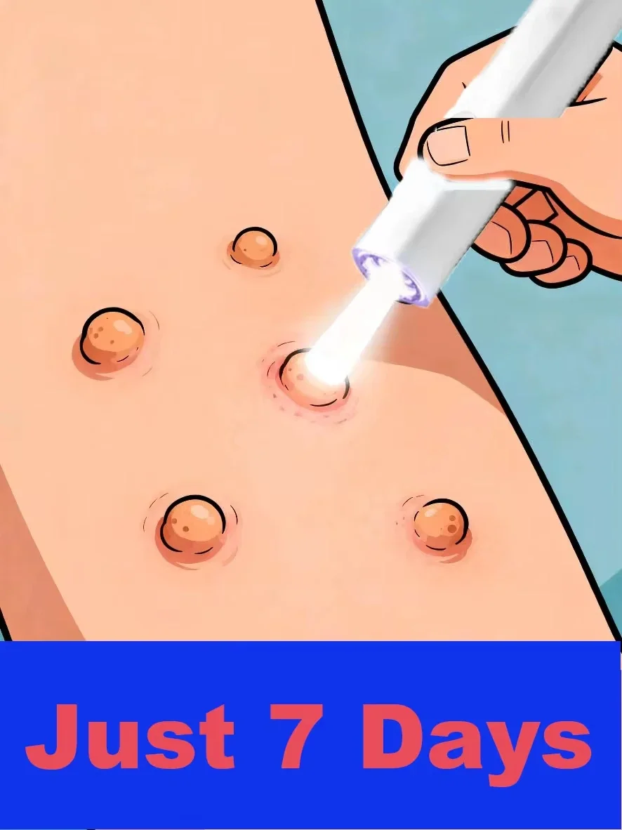 2025年アップグレード版レーザーペン-効果的に問題を解決します