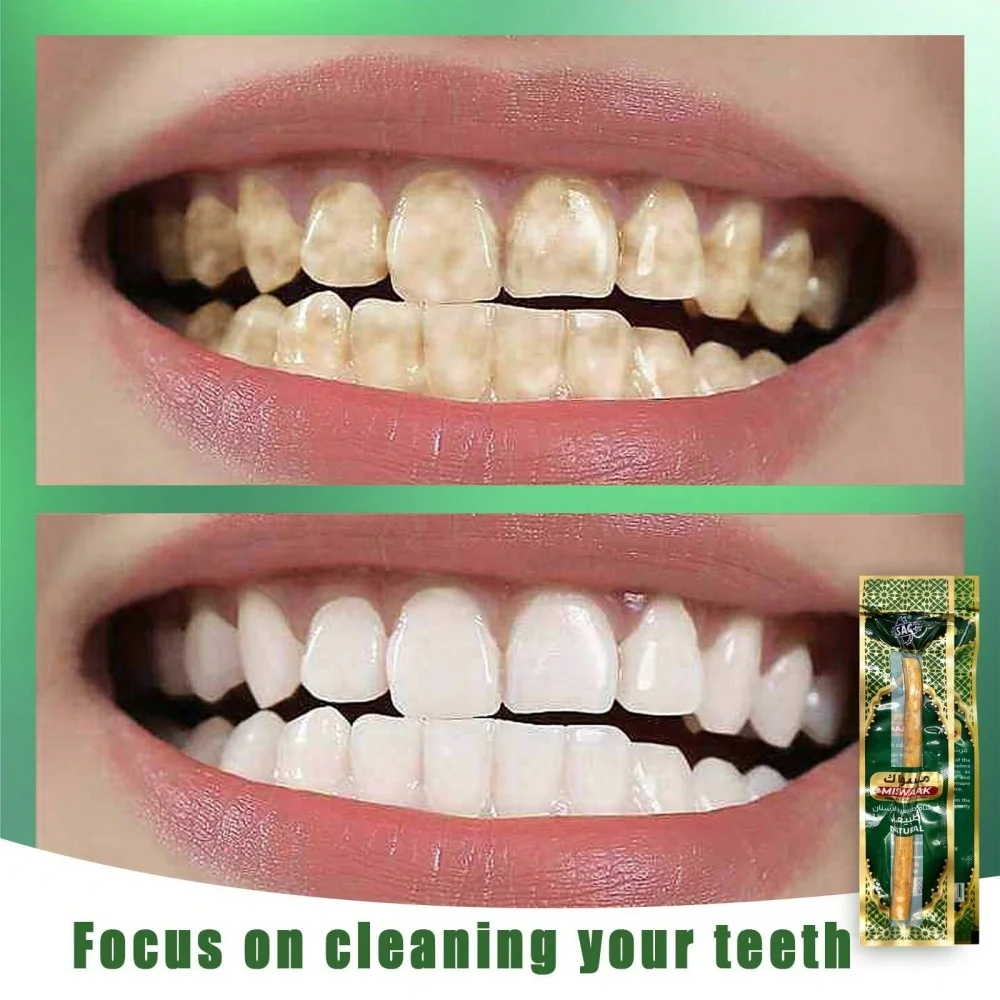 Natürliche Miswak-Zahnbürste, vakuumversiegelt, natürlicher Geschmack, traditioneller Zahnbürstenstift für gesundes Zahnfleisch, zähne frischerer Atem, Geschenk