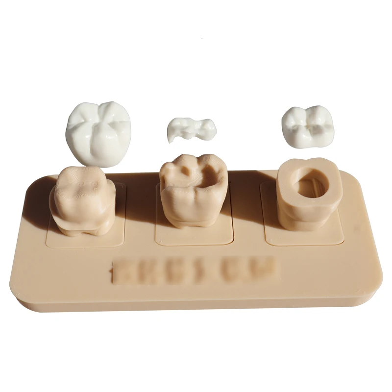 Embedded Restoration Model, Oral Teaching Model, Removable Dental Prosthesis Model, Doctor-Patient Communication Model
