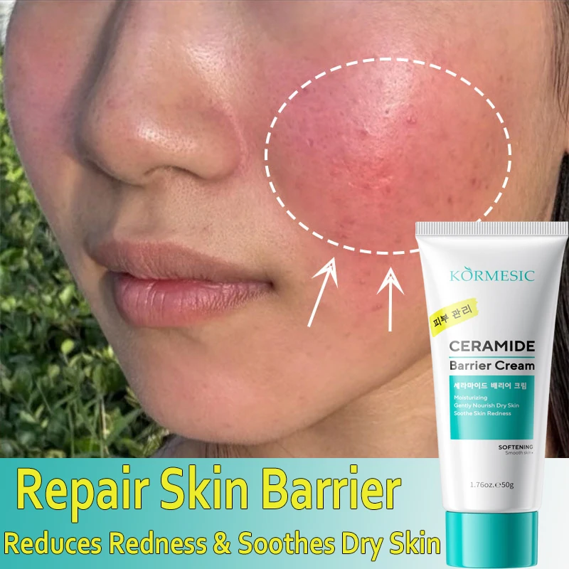Facial Redness Reduce Cream Improve Sensitive Skin Dryness Moisturizer Hydrating Sooth Lotion Rosacea Decrease Korean Cosmetics