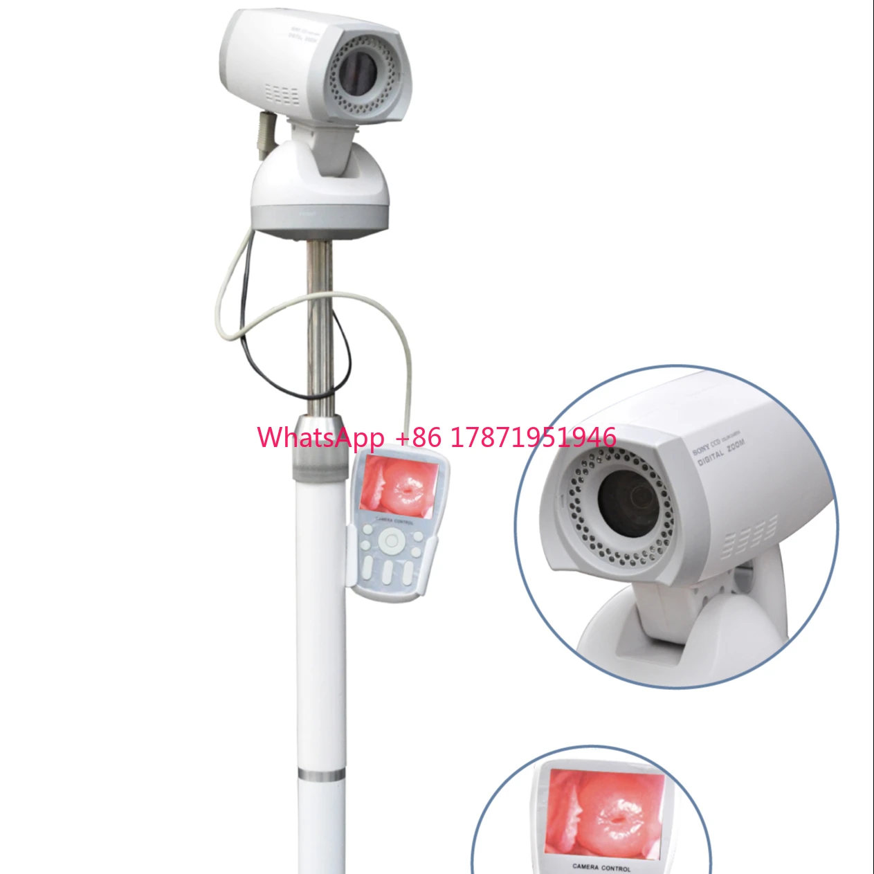 

Video Colposcope With Tripod Gynecological Clinical Diagnostic Instruments