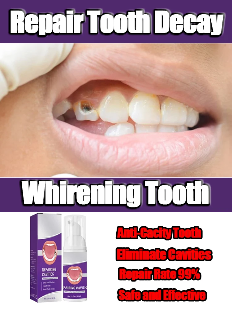 

Effective Teeth Whitening Tooth decay repair Calculus Plaque Periodontitis Remove Cavities