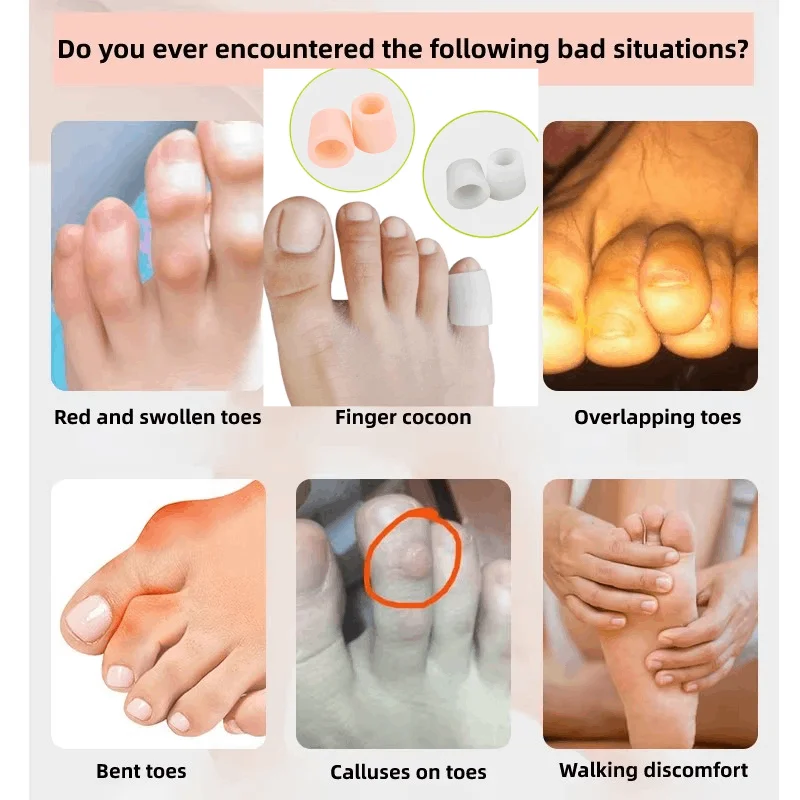 

1/10Pairs Silicone Gel Little Toe Tube Corns Blisters Corrector Pinkie Protector Gel Bunion Toe Finger Protection Gel Sleeve
