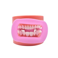 2 Pcs Silicone Mouth Opener Dental Cheek Retractor for Teeth Whitening Reusable Intraoral Lip Retractor (Multi-colored)