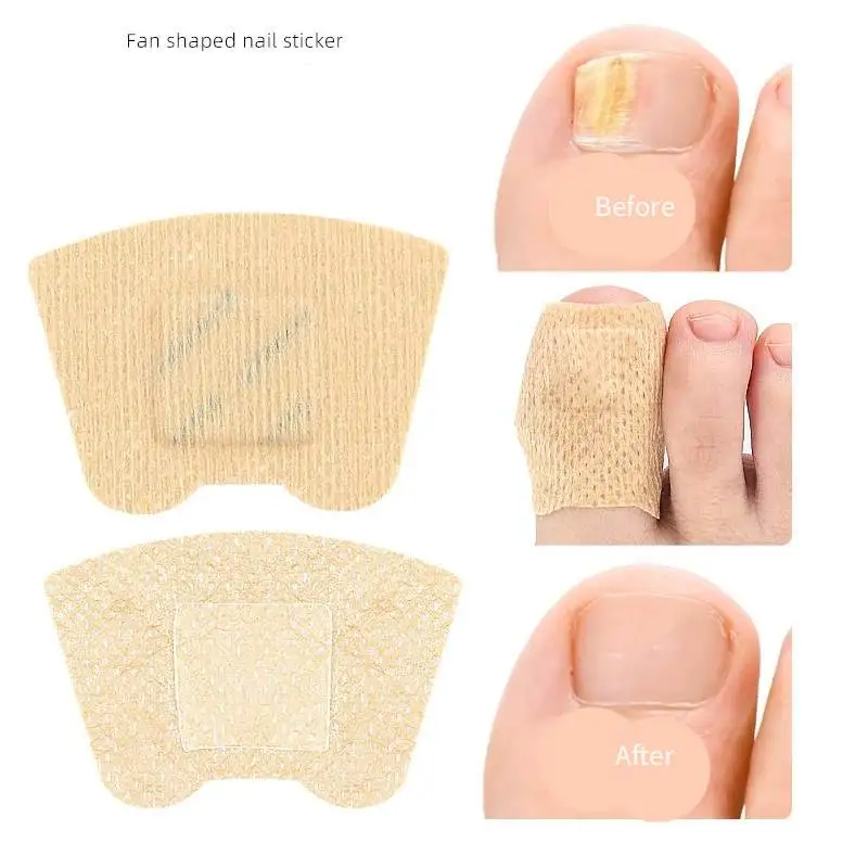 21pcs Waterproof Nail Fungus Patch Ingrown Toenail Correction Sticker Damaged Gray Nail Repair Care Feet Tools