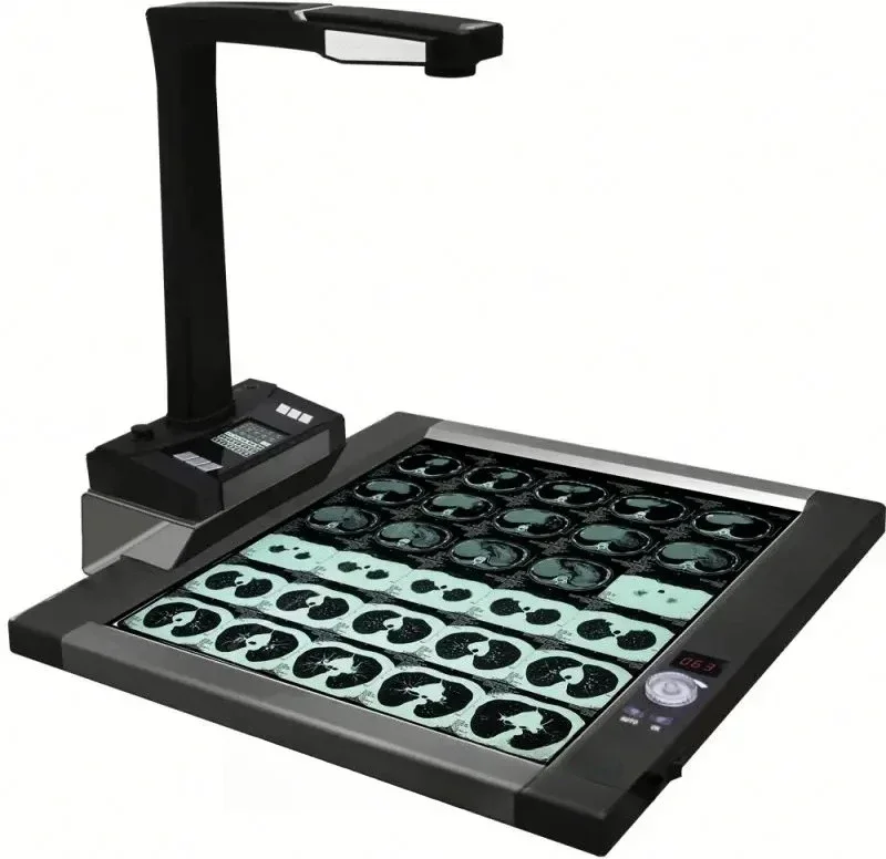 Joyusing CT160 X-Ray Film Scanner for Hospital and Clinic Diagnosis
