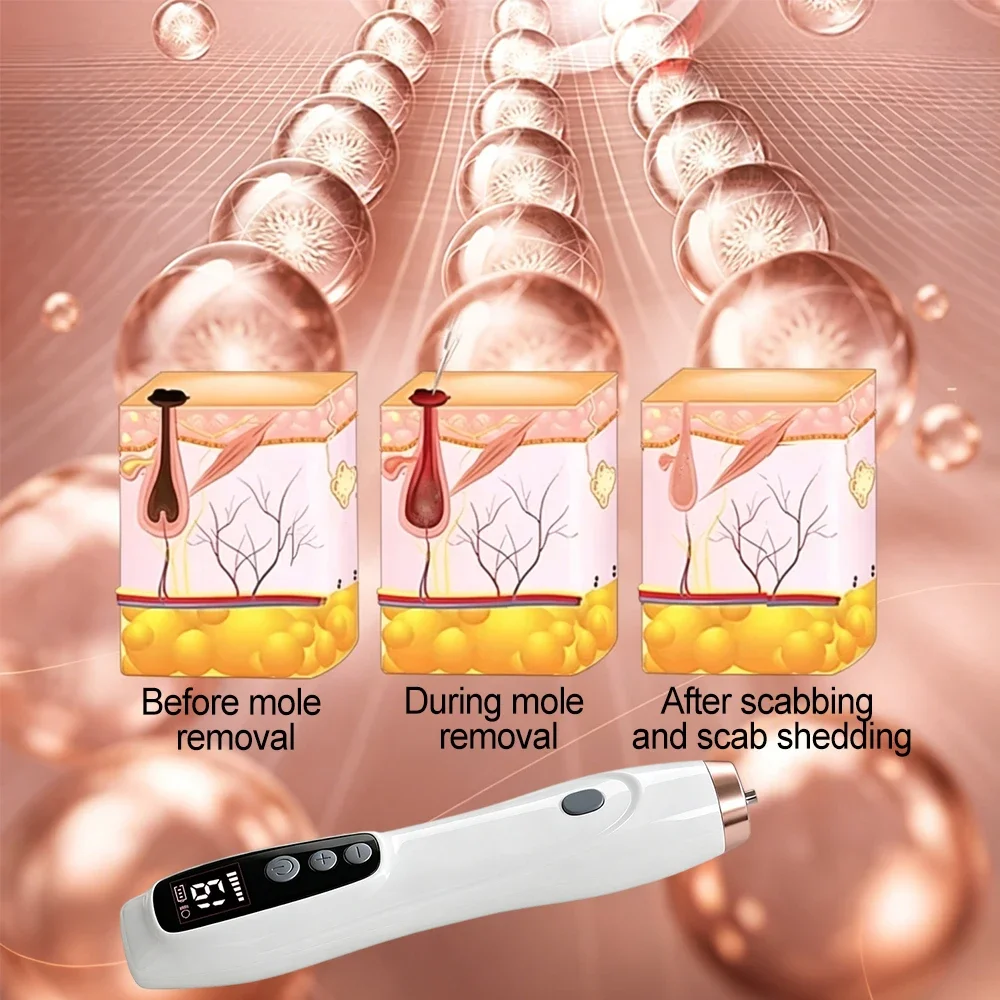Professionelles 9-Stufen-LCD-Display Fibroblast-Plasma-Pen Augenlidstraffung Hautflecken-Entferner Muttermale Warzenentferner Schönheitsgerät für Zuhause – Detail 20