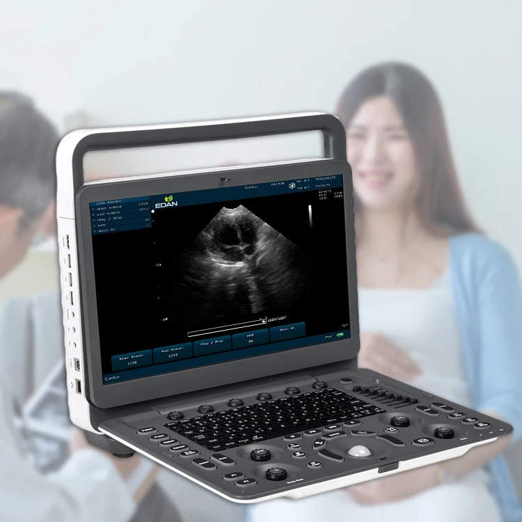 sonoscape e1 exp expert machine 4d ultrasound