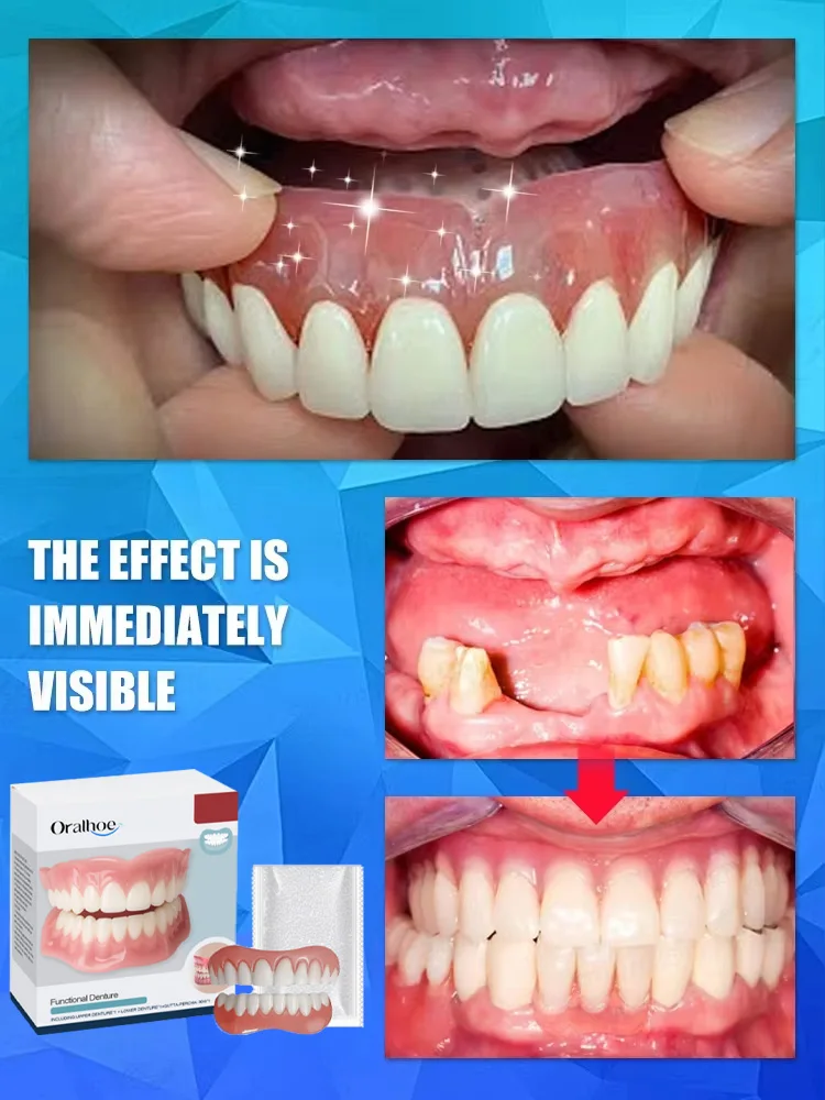 

Новый силиконовый набор для временных ортодонтических зубных протезов: верхние и нижние искусственные зубы, имитация брекетов для гигиены полости рта и отбеливания.