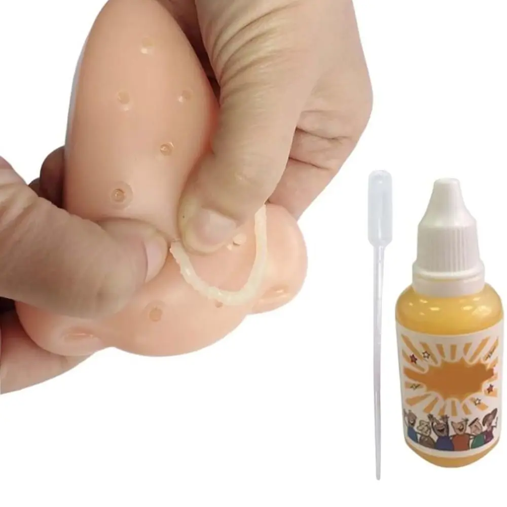 Stress Relief Skin Picking Fidget mit 30 ml Additivlösung Skin Picking Squeeze Akne Neuheit Squeeze Akne Pickel Pops Toy