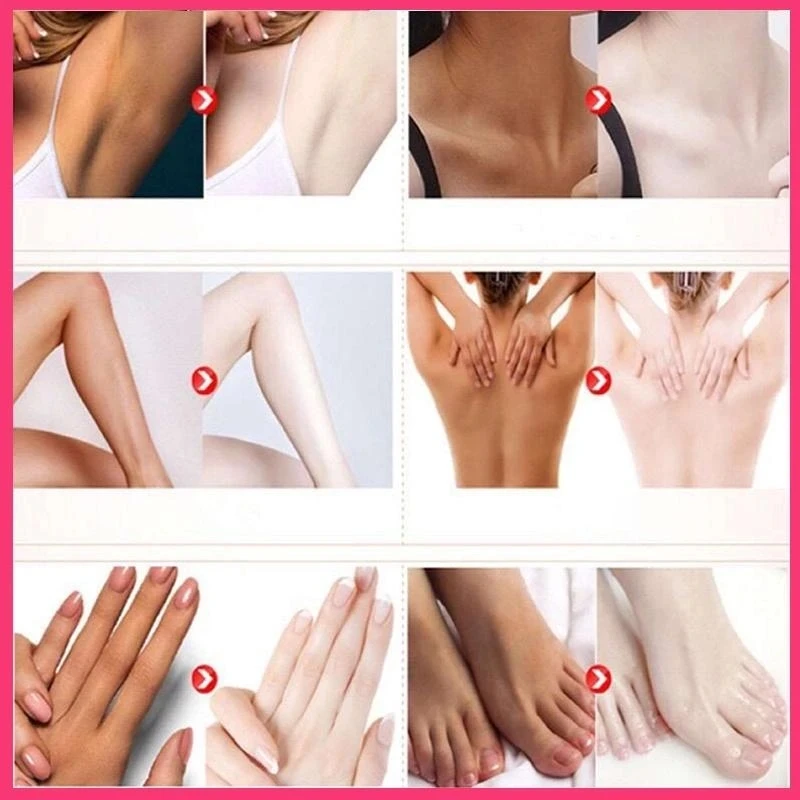 Private body whitening cream armpit buttock nipple private area pink essence to remove melanin brighten beauty care Melanin remo