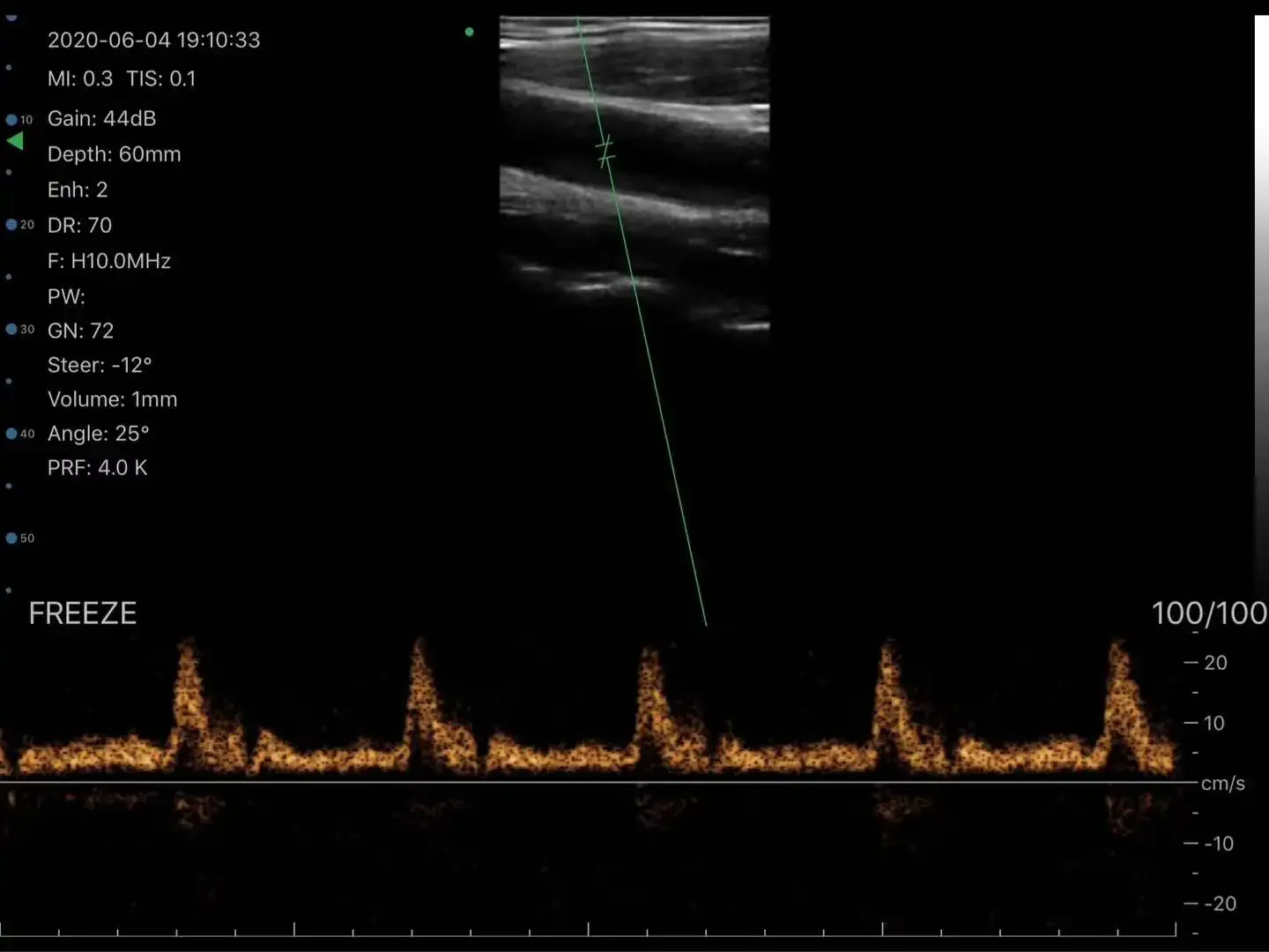 Wifi USB Color Ultrasound Probe Double Head Convex Linear Probe