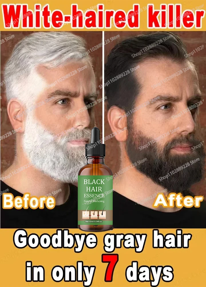 Anti Gray Hair Essence Hair Serum Get Rid of White Hairs  Repair Care Nourish Scalp Anti Hair Loss925