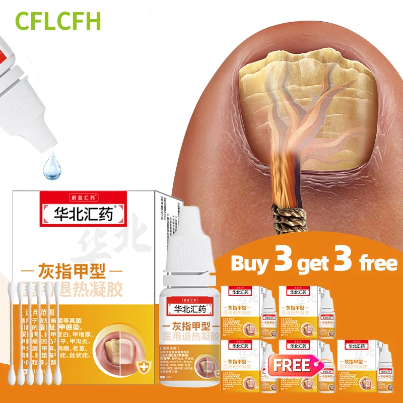 

6Boxes Fungal Nail Treatment Oil 10ml Paronychia Feet Nails Repair Serum Essence Anti Infection Onychomycosis Care Products