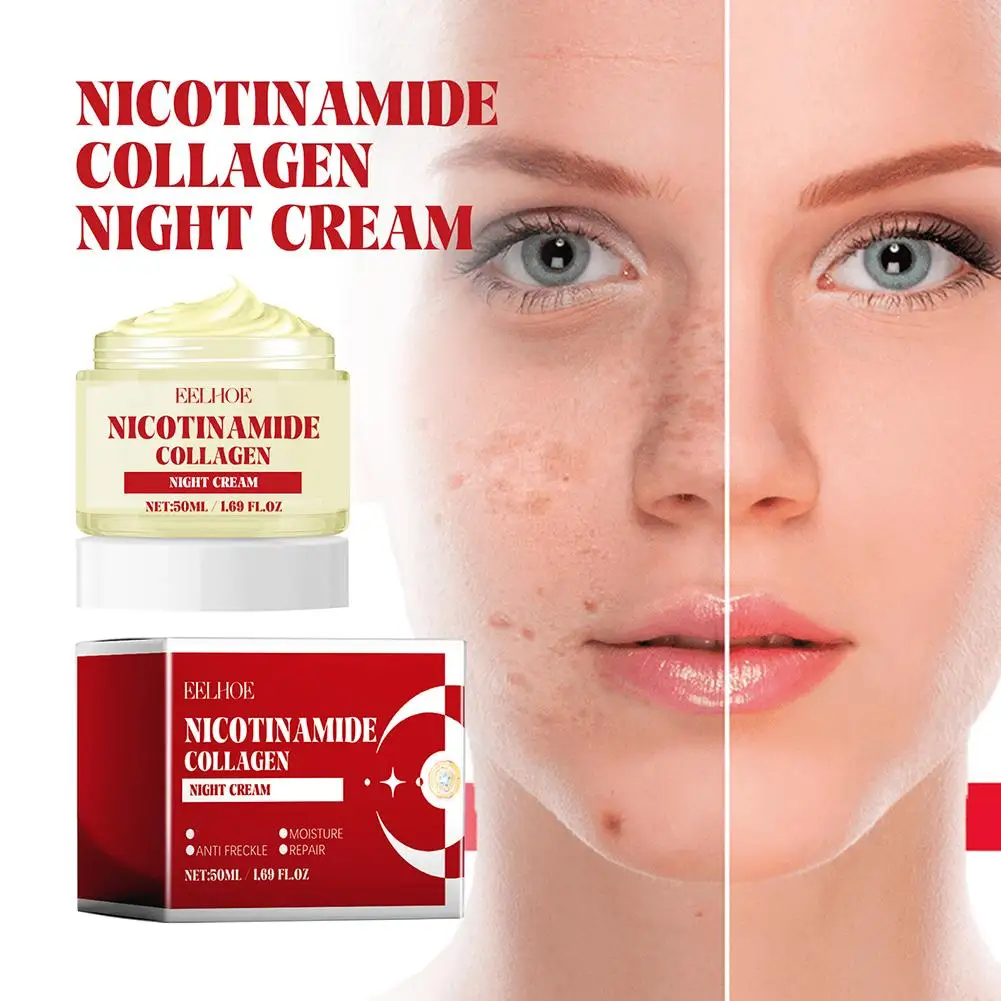 Crema blanqueadora de niacinamida para pecas, aclara eficazmente las manchas negras, elimina el cuidado de las manchas, el acné, Melasma, ilumina la piel, 50ML, K1J1