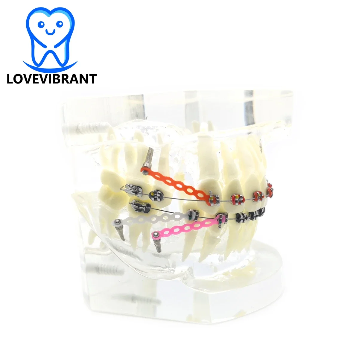 Dental Teeth Model Orthodontic Treatment Study Demo Model For Teaching And Hospital Dentist Orthodontic Model