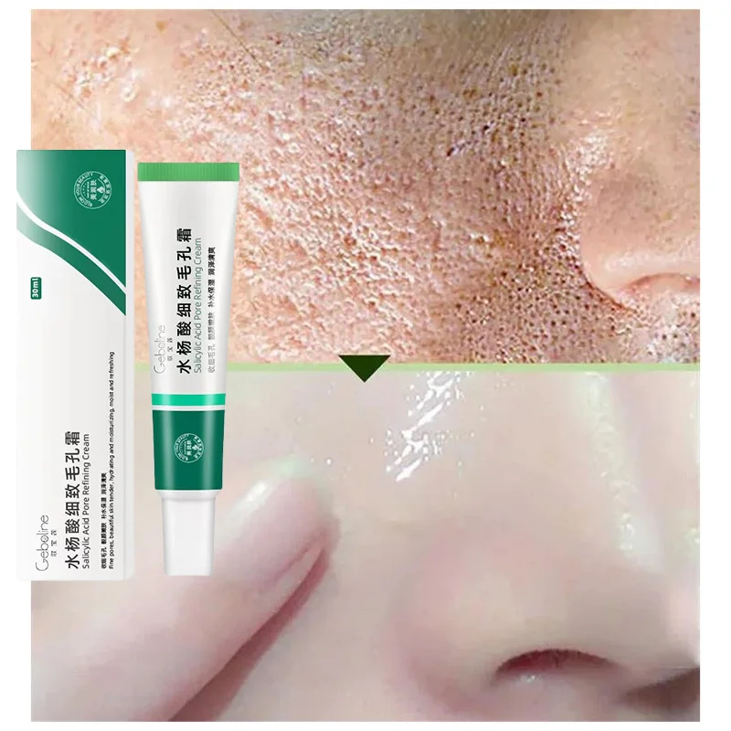 Salicylic Acid Pore Shrinking Cream Quick Elimination Large Pores Remove Blackehead Tighten Face Smooth Skin Korean Care Product