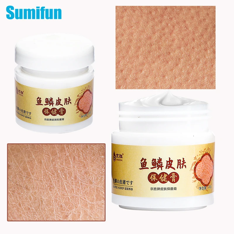 

Chicken Skin Remover Cream Curing Keratosis Pilaris Skin Repair Ointment Dry Peeling Ichthyosis Treatment Exfoliator Body Legs