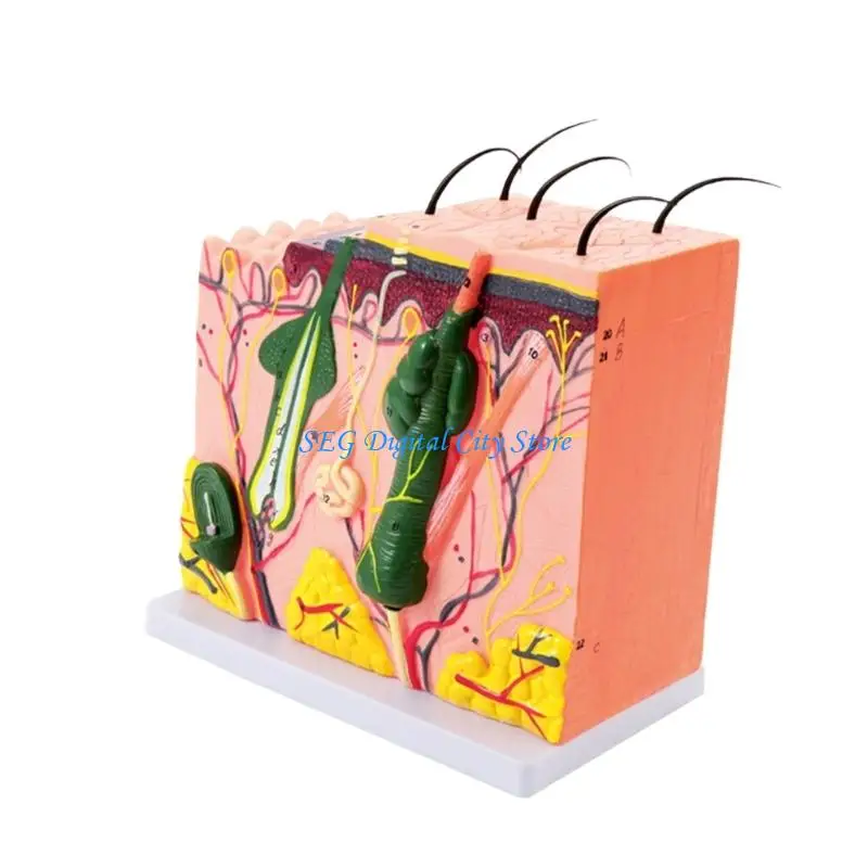 U75B Skin Model 35/50/70/85X Enlarged Anatomical Skin Layer Structure Model for Science Learning Teaching Display