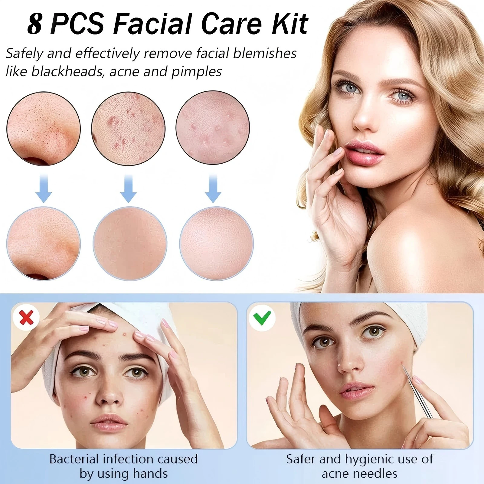 Kit per la rimozione di punti neri in acciaio inossidabile, strumento per bottiglie di imperfezioni e acne per tutti i tipi di pelle, confezione da 8