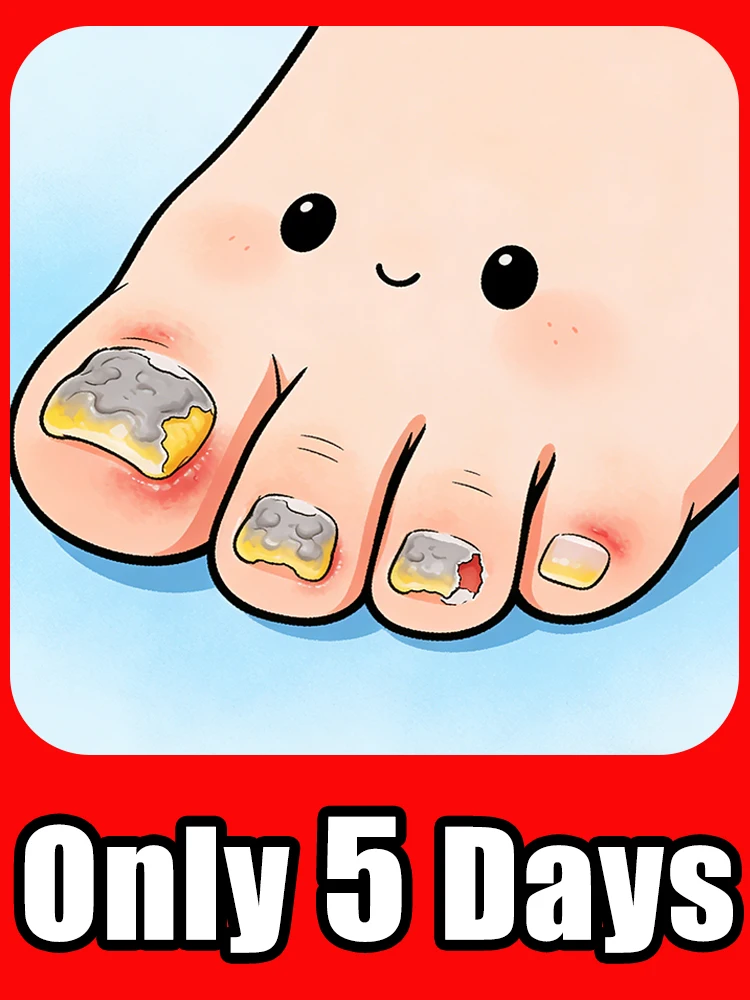 

Long-Lasting Fungal Nail Patches: Revitalize & Strengthen Nails