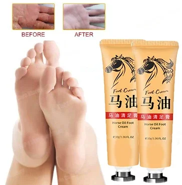 Advanced Repair Hand Cream For Dry Cracked Hands Luxury Moisturizing Nourishing Repairing Natural Lotion Horse Oil Skin Cream