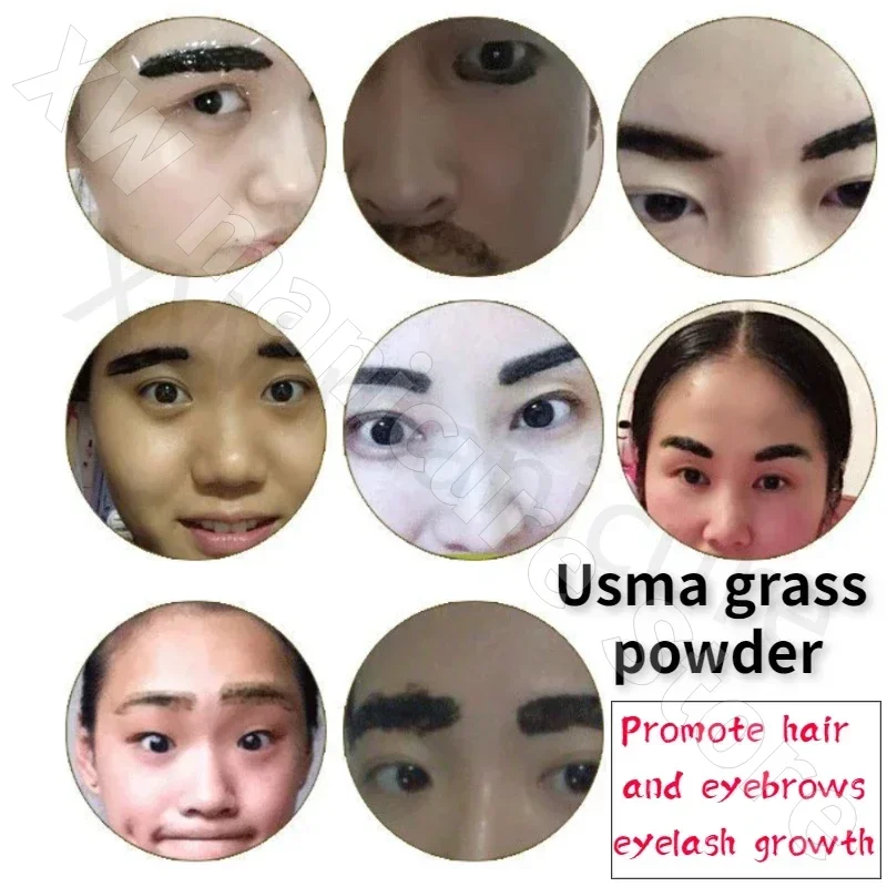 ซินเจียงเพียว อุสมาน หญ้า น้ำหญ้า ขี้เลื้อย คิ้ว เส้นผม เครา สากล อุสมาน หญ้า น้ำหญ้า น้ำยาเร่งการเจริญเติบโต 1 ขวด 10 มล.