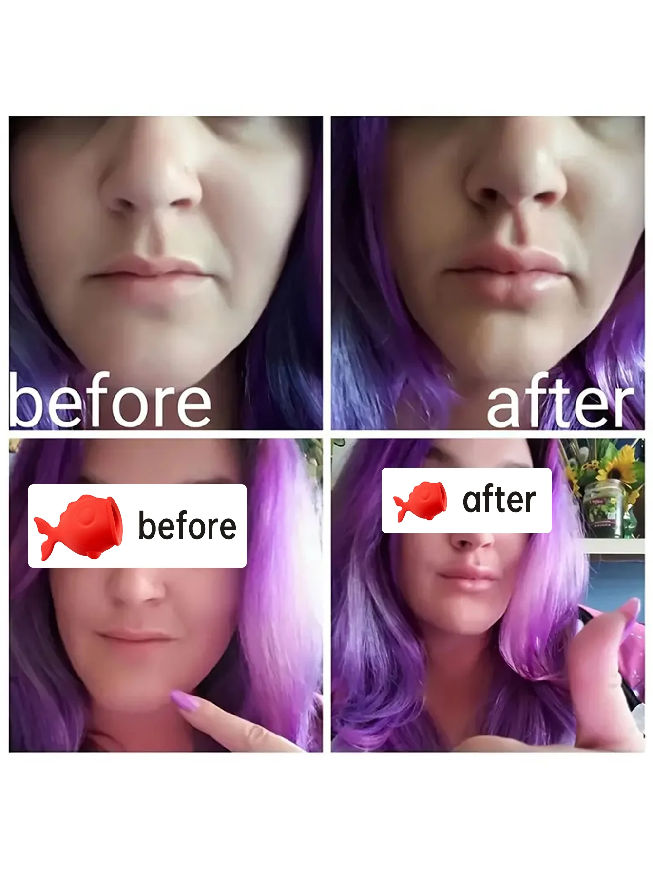 جهاز سمنة الشفاه للشفاه الكاملة - قطعة واحدة من أداة نفخ الشفاه المصنوعة من السيليكون على شكل فم السمكة اللطيفة