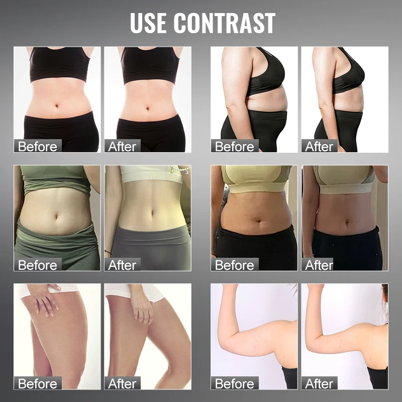 New Indiba 448Khz Monopolar RF CET Face Lifting Machine RET Body Slimming Reduction Diathermy Skin Tightening Deep Care Machine