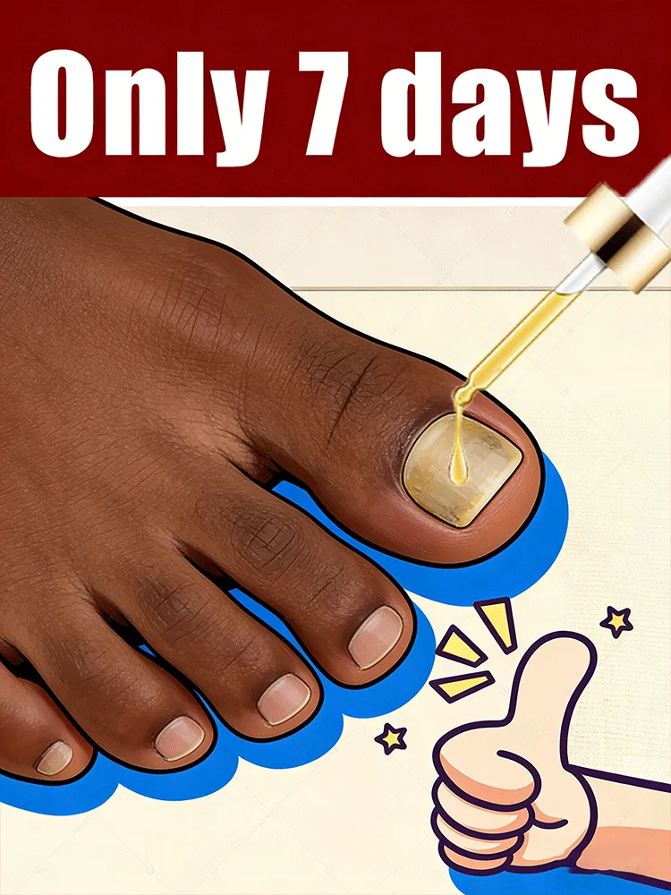 

Лазерная ручка Необходимое устройство для лазерной терапии с синим светом для всей семьи, ногти становится полупрозрачным и без грибка.