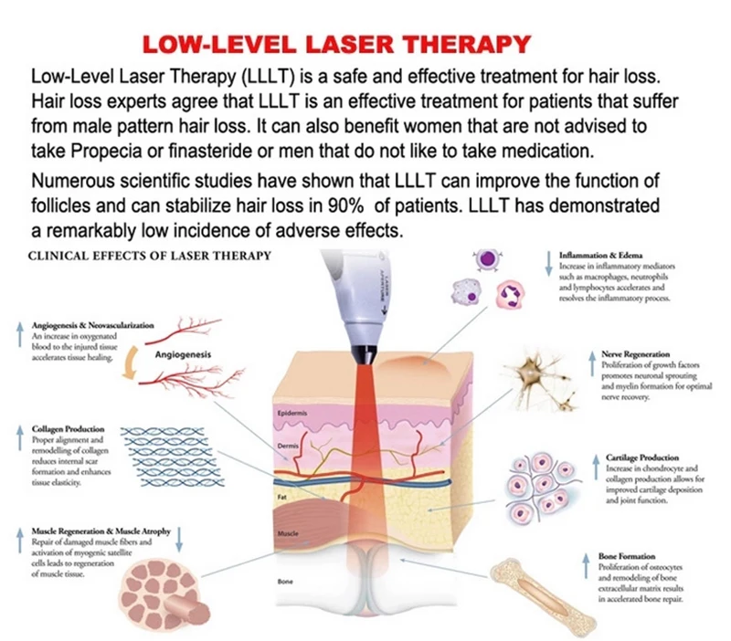 Détection du cuir chevelu, physiothérapie, instrument complet, nouveau lazer générateur de cheveux, soins de la tête, croissance des cheveux, hall spécial