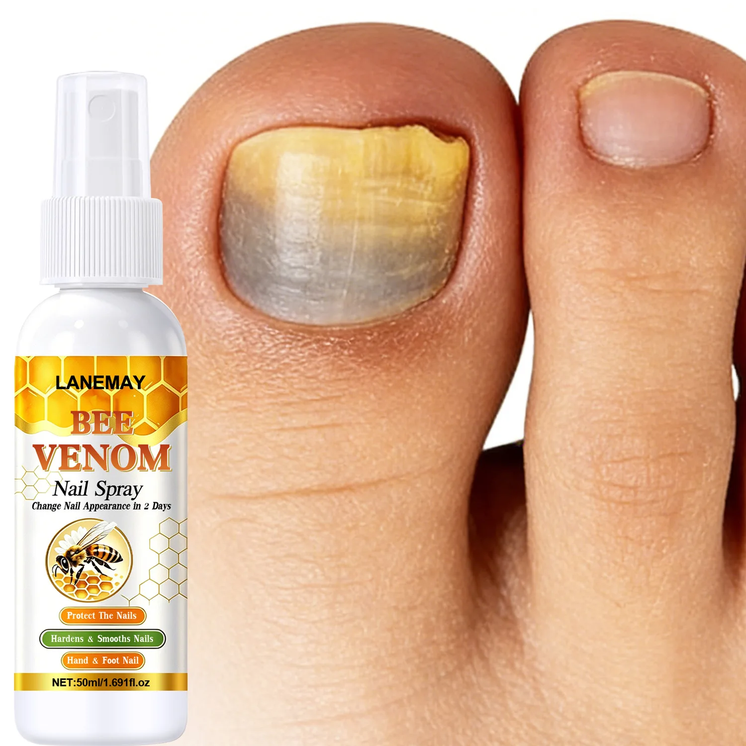 Bee Venom Nail Spray with Tea Tree Oil– Moisturizing Treatment for Hand and Foot Nails, Helps Improve Nail Appearance in 2 Days.