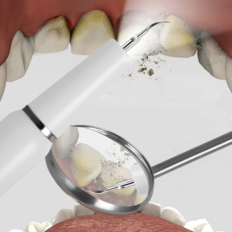 مزيل البلاك لمزيل جير الأسنان للأسنان مزيل حساب التفاضل والتكامل الأسنان