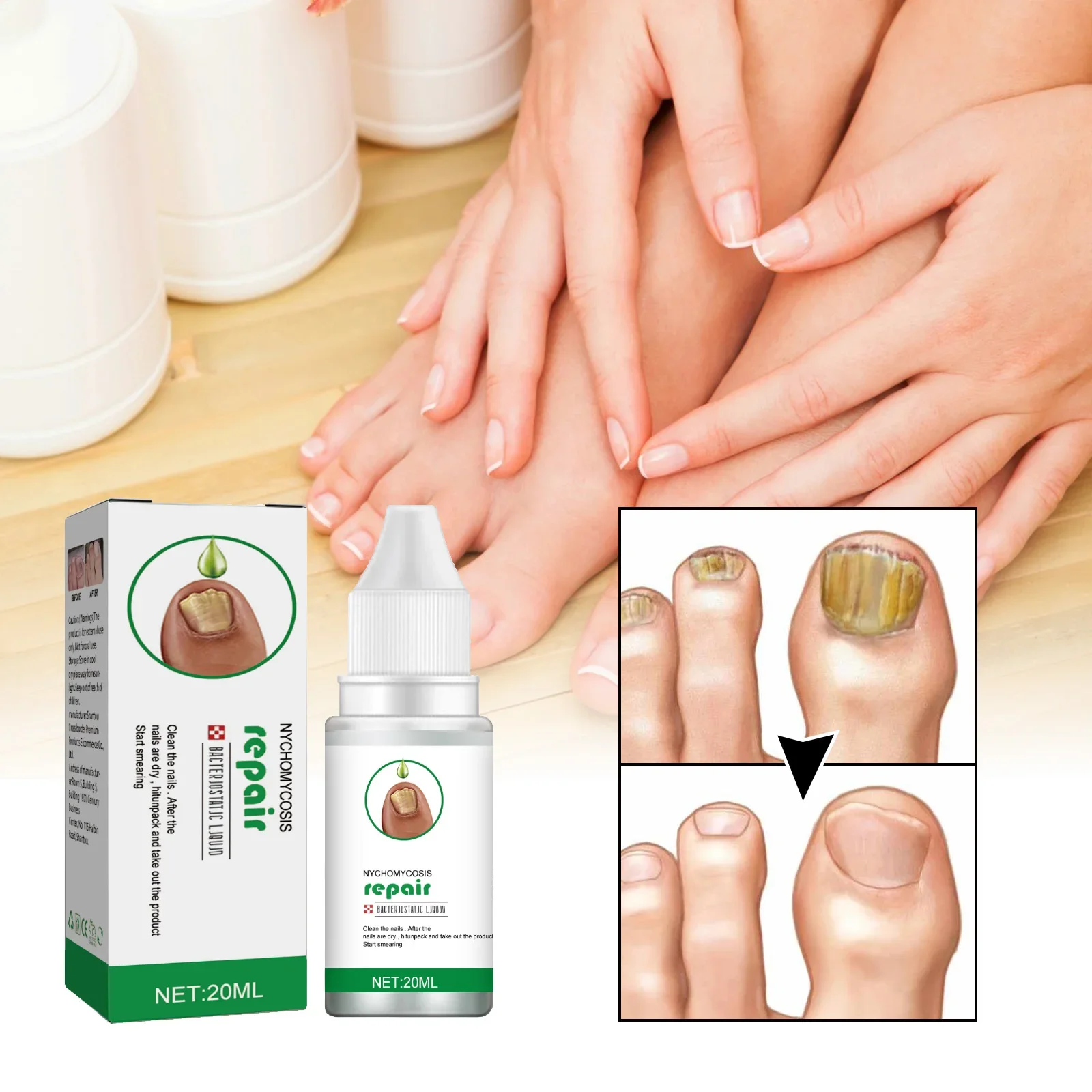 

Nail Fungals Renewal Nail Repair Liquid for Discolored Thickened Crumbled Nails Nail Fungals for Discolored Broken Cracked S5F62