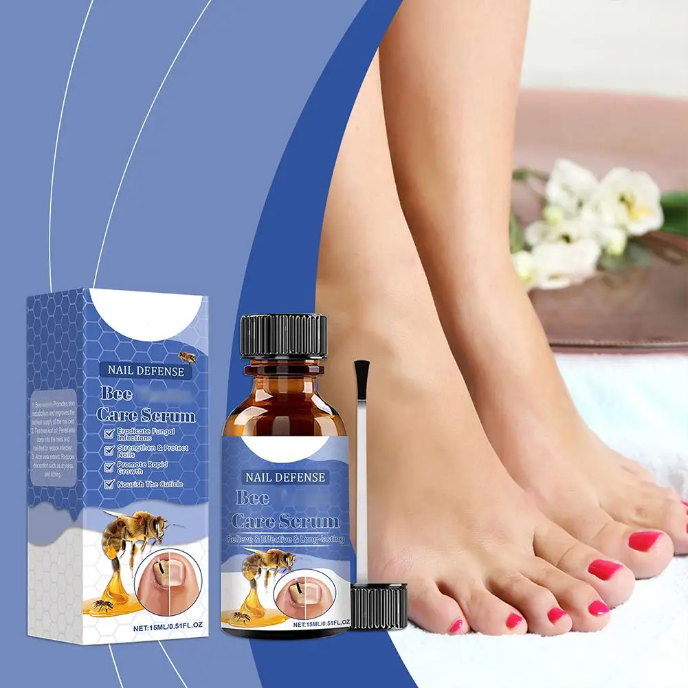 خلاصة العناية بفطر onycosis لسم النحل للأظافر والأظافر السميكة وأصابع القدم ، إصلاح سريع ، علاج ، العناية بالقدم ، 15 فطر