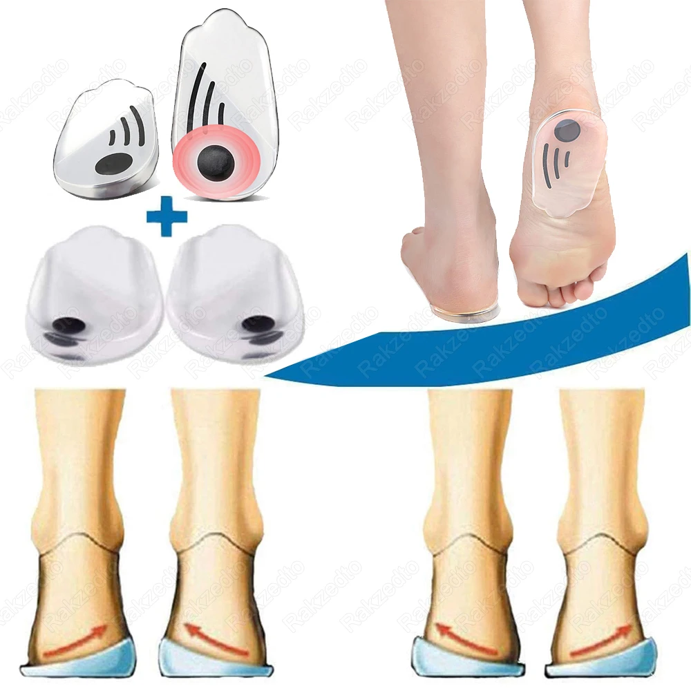 

Silicone Orthopedic Insoles for Feet Man Woman O/X Leg Type Varus Knee Correction With Magnet Massage Heel Insert Gel Shoes Pads