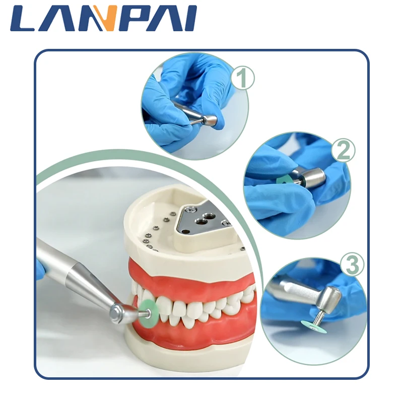 Lanpai Tandheelkundige Polijstschijven Bruto Tandheelkundige Verbruiksartikelen Strepen 40/80 Stuks Tandheelkundige Soflex Disc Polijstmachine