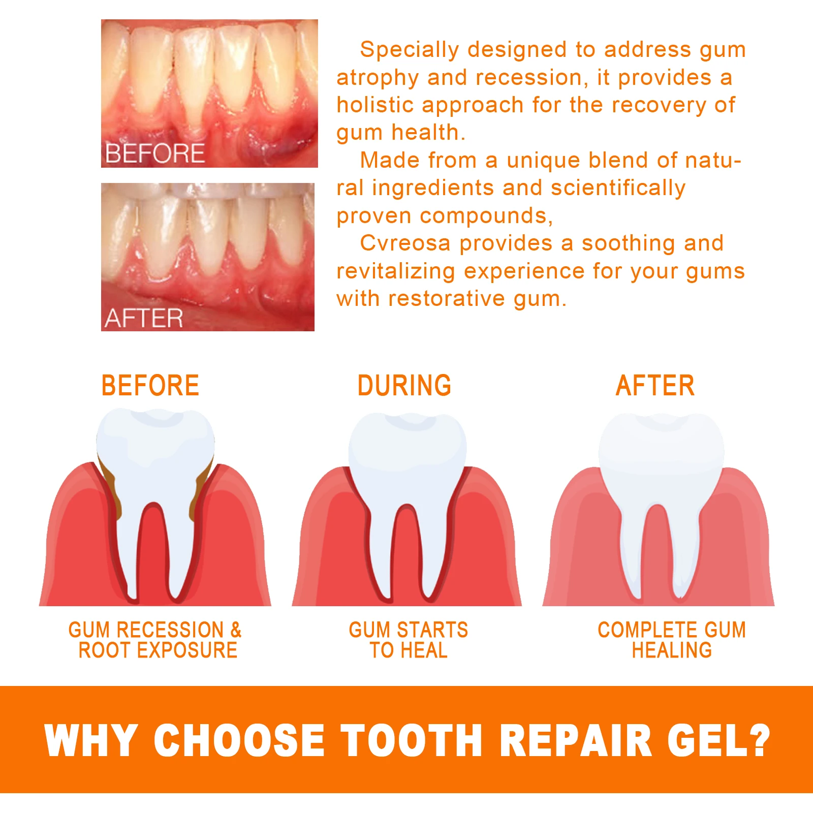 Essência para reparação de gengivas EELHOE limpa os dentes e protege as gengivas para reduzir a sensibilidade das gengivas. Gotas para reparo de gengiva, cuidados bucais veganos