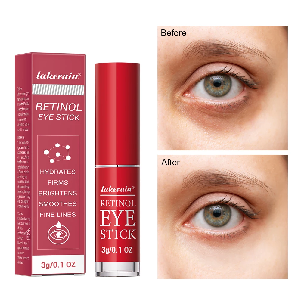 

Retinol Eye Stick Anti Aging Brigthening Eye Cream For Puffiness And Bags Under Eyes Eye Balm Reduce Find Line Dark Circles