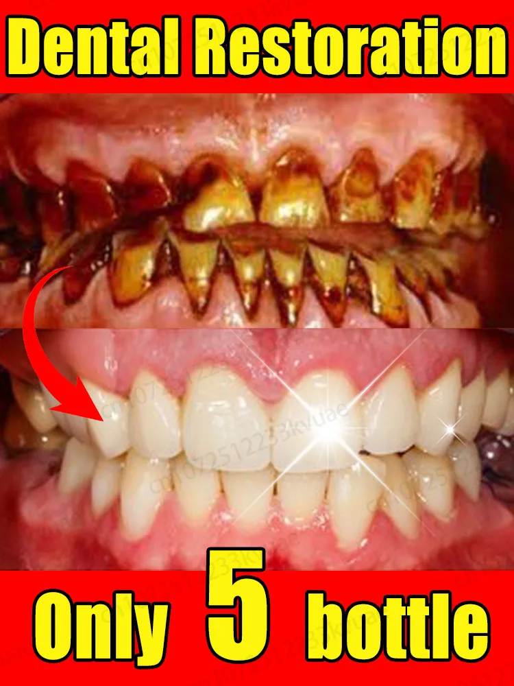 Clean teeth and solve tooth decay at one time