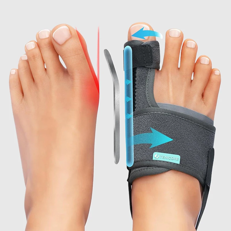 2 Stück Zehenorthesen Hallux Valgus Orthesen Orthopädisches Werkzeug Pflegewerkzeuge