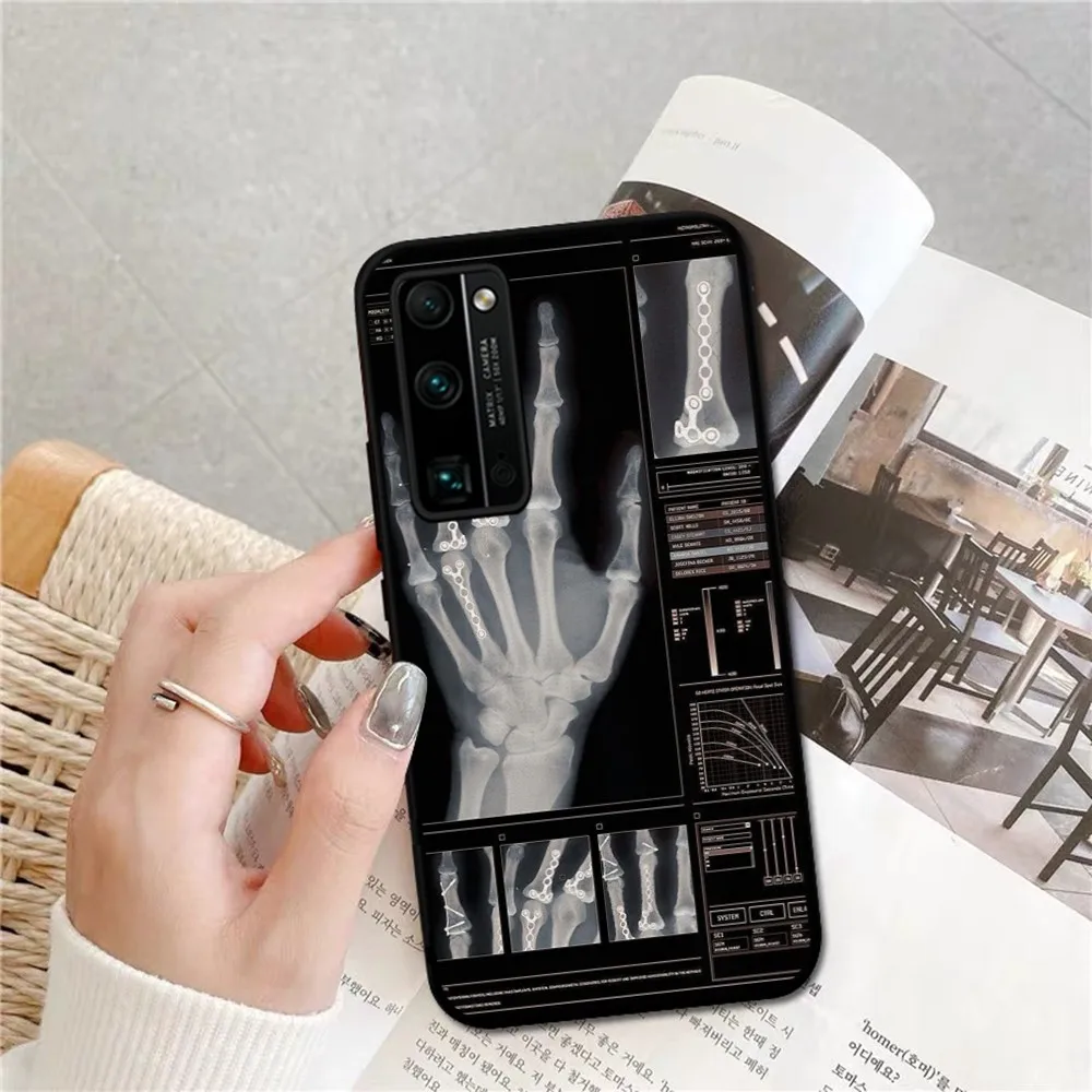 Radiological human organs Skeleton Phone Case For Huawei Honor 10 lite 9 20 7A pro 9X pro 30 pro 50 pro 60 pro 70 pro plus